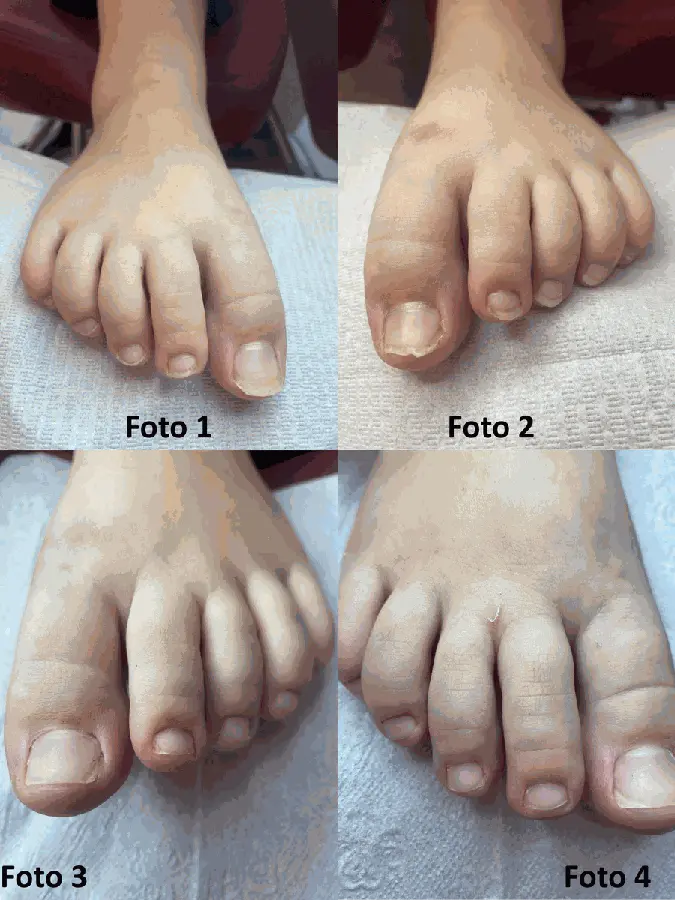 Registro de podoprofilaxia